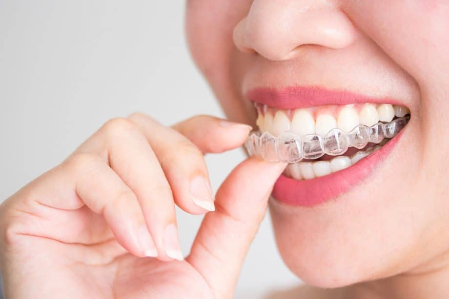 Pros and Cons of Using Invisalign