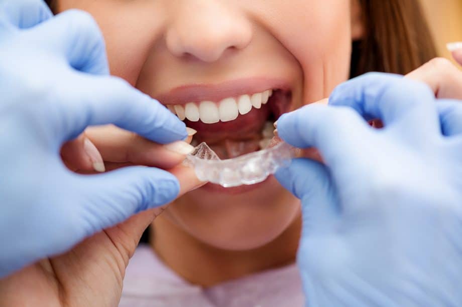 Orthodontists helps patient to insert Invisalign tray