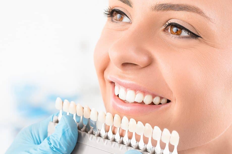 What Should I Eat After Teeth Whitening?